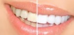 tay trang rang theo cach dan gian