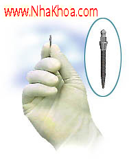 Mini implant là gì? Được dùng trong trường hợp nào? Mini implant la nhung implant co kich thuoc nho co hinh dang giong cay dinh vit