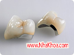 Su kim loai IPS.Design