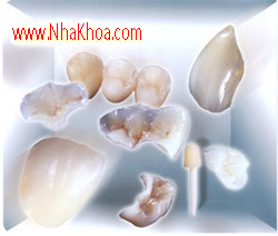 Phuc hinh rang sam bang Veneer su co dinh