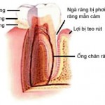 hinh anh nha khoa cho rang nhay cam