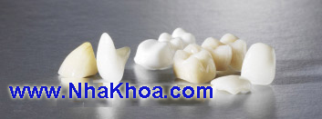 Mao vinh vien co the la mot trong cac loai sau: kim loai, quy kim, su kim loai, su quy kim, toan su,...