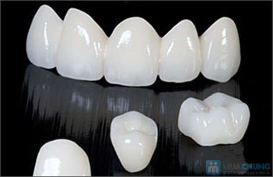 cong nghe rang su hien dai