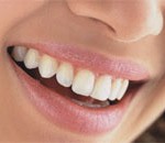 phuc hoi mau rang trang sang bang cong nghe rang su