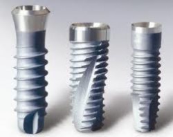 implant viet nam da tiep can implant nhu the nao